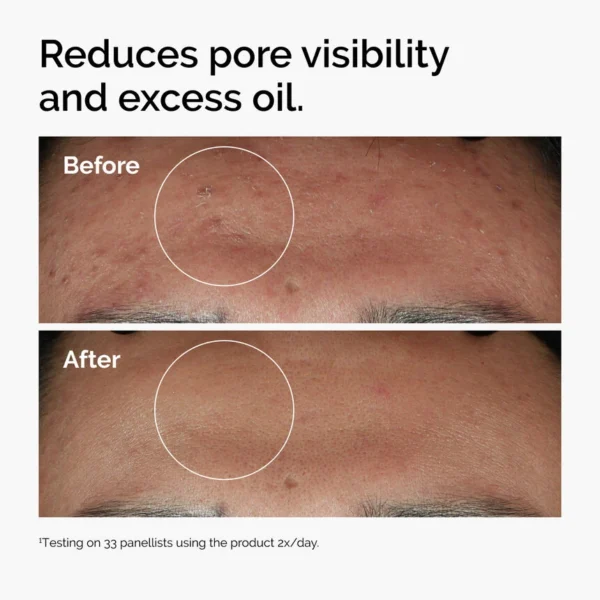 ord-niacinamide-zinc-blemish-serum-before-after-pores